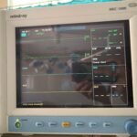 Monitor of Anesthesia Machine